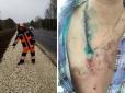 Хіти тижня. Хрестик на грудях врятував чоловіка від удару блискавки (фото)