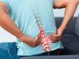 Медики б’ють на сполох: 90% засобів від болю в спині - марні. Що дійсно працює