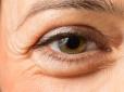 Не пропустіть! ТОП-4 неочевидні ознаки проблем з очима