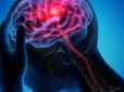 Ви могли це не знати! Названо несподіваний продукт, який збільшує ризик інсульту