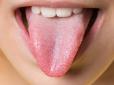 ТОП-8 хвороб, які можна діагностувати за станом язика