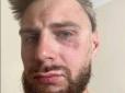 У Чехії група поляків жорстоко побили співвітчизника, прийнявши його за українця